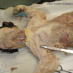 pectoantebrachialis_L.JPG