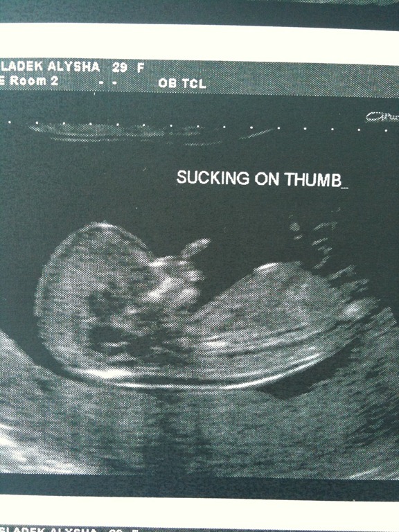 [12%2520week%2520ulstrasound%2520pic%255B5%255D.jpg]