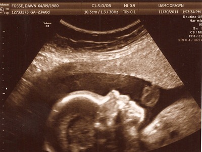 child #4 ultrasound 3