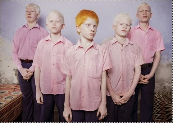 [albinos2.jpg]