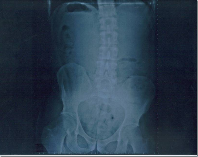 Radiografia_caderas_JMM_2_N_2011