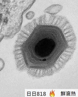 智利發現 百萬病毒 最大病毒 Megavirus chilensis