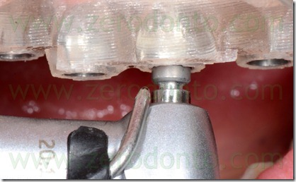 blog.072 blog.072