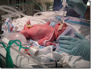 Licoln's Birth Aug 15 2011 006