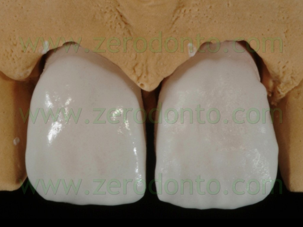 [90-stratificazione-ceramica-massa-de.jpg]