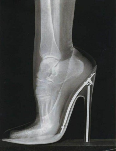 Radiografía tacones Radiografía tacones