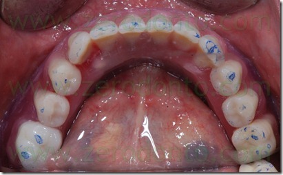 prova denti