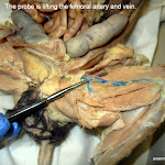 femoral_artery_vein_L.JPG