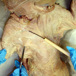 deltoid.JPG