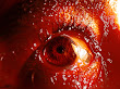 Bloody Eye Big