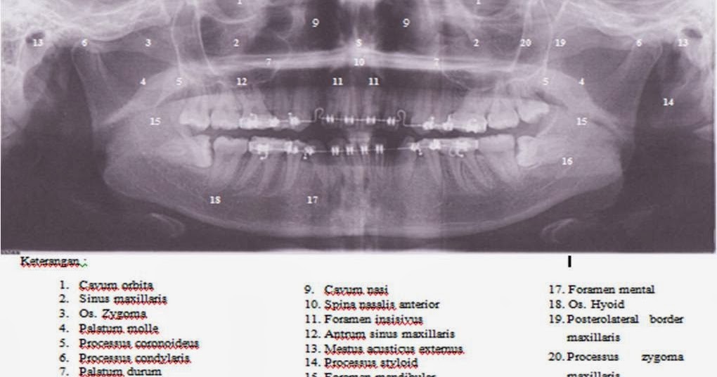 Foto Panoramik ~ Dent-ias || notes