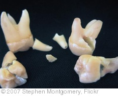 'Wisdom Teeth' photo (c) 2007, Stephen Montgomery - license: http://creativecommons.org/licenses/by-sa/2.0/