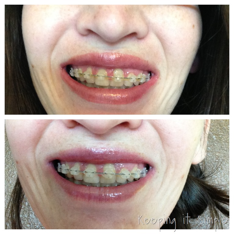 [IMG_4821%255B8%255D.jpg]