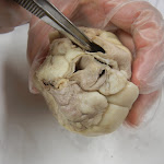z_pulmonary_trunk_probe.JPG