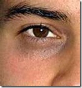 dark_circles dark_circles