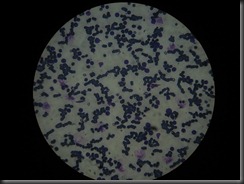 all acute leukemia  high resolution histology slide tsnaps