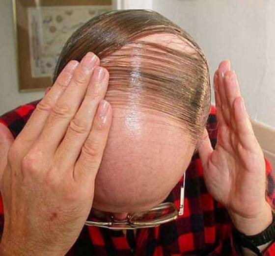 [bad_comb_overs_14%255B2%255D.jpg]
