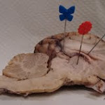 brain_dissect20.jpg brain_dissect20.jpg