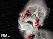 Xray Bleeding Skull Horror