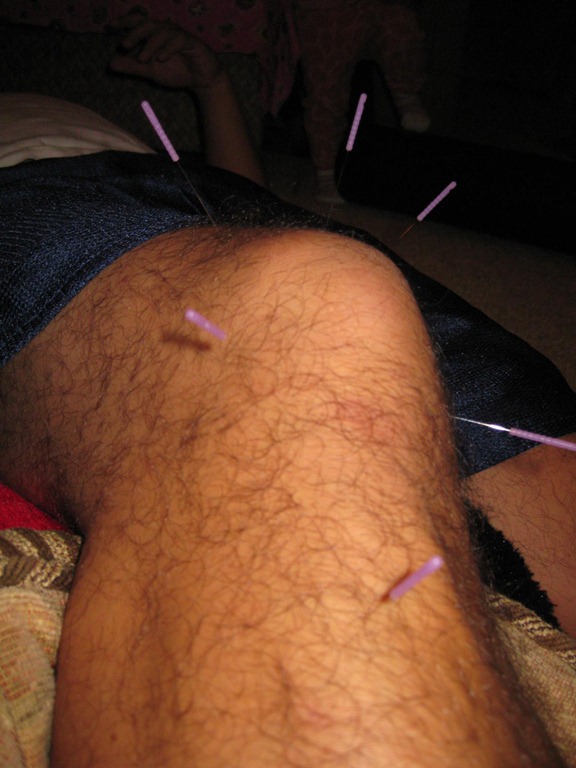 [knee%255B3%255D.jpg]