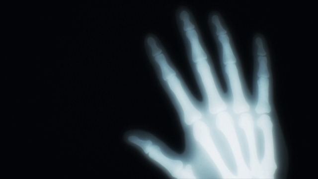 [Chihayafuru%25202%2520-%252020%2520-%2520Large%252018%255B2%255D.jpg]