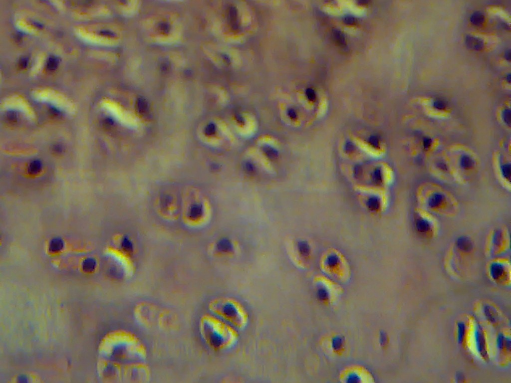 [Hyaline%2520cartilage%2520highly%2520magnified%2520microscopy%255B4%255D.jpg]