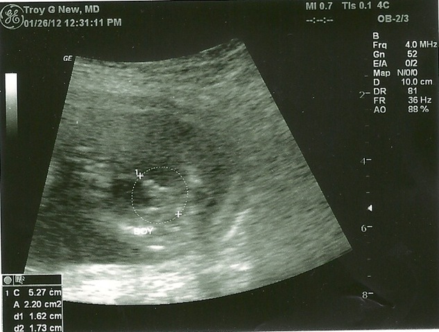 [baby%2520boy%252010006%255B3%255D.jpg]