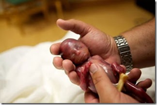 صورة طفل مولود في الأسبوع ال19 أي فى الشهر الرابع - 7