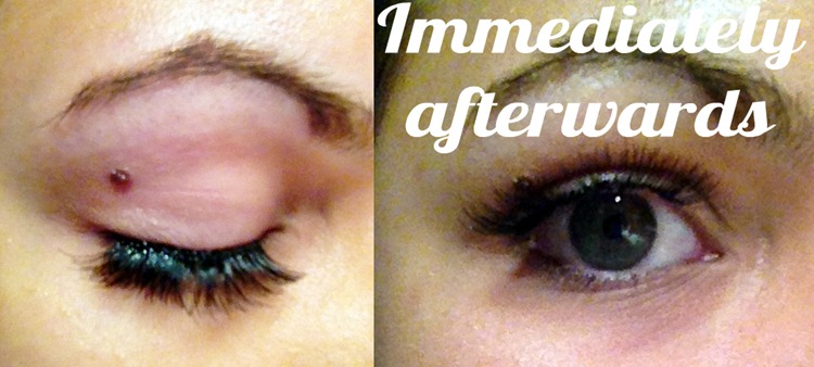 Eyelash extensions after Eyelash extensions after