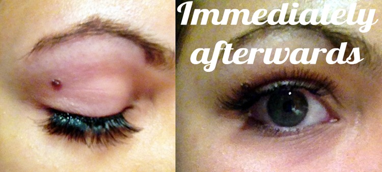 Eyelash extensions after