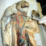 larynx_L.JPG