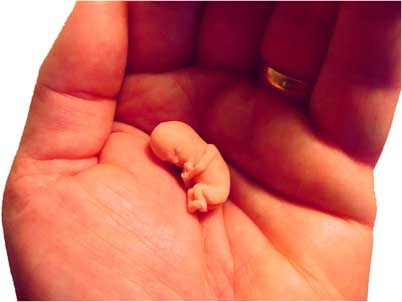 [life_8weeks%255B2%255D.jpg]