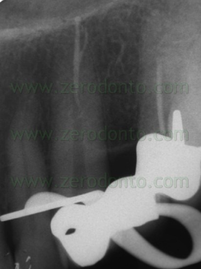 [FIG-N-23-2.jpg]