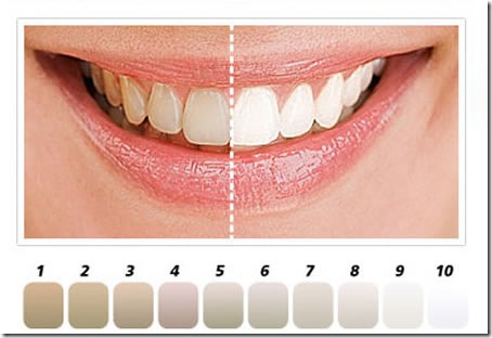 teeth whitening3