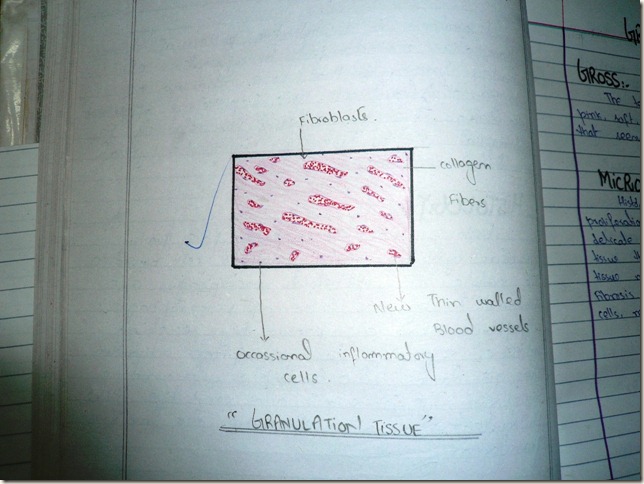 granulation tissue handmade diagram histopathology