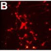 Neurons infected_transfected_small.jpg