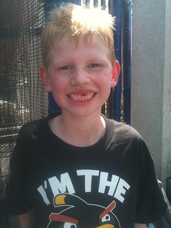 [Sammy_losttooth_April7%252C2012%255B6%255D.jpg]