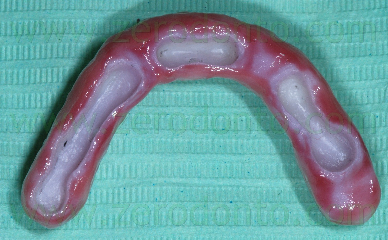[zirconia-core2.jpg]
