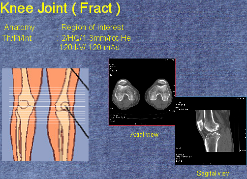 [KNEE-JOINT2.png]