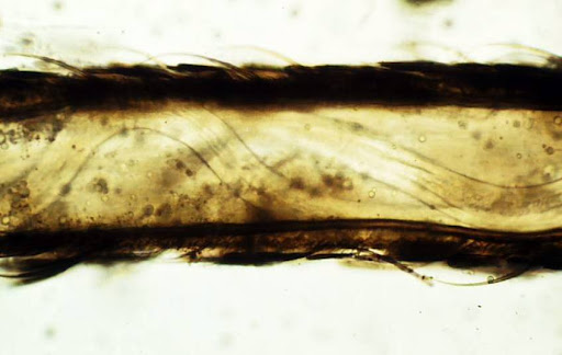 larvae breast infection. Brugia malayi larvae in