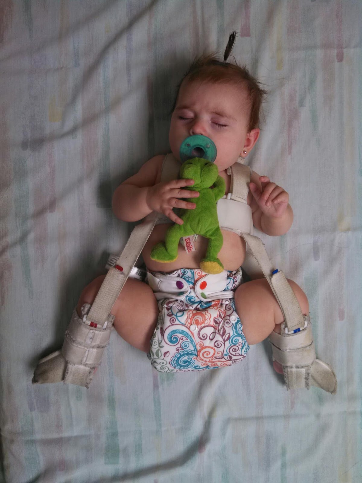 Froggied Princess Our life with a WheatonPavlik Harness 11 Weeks in