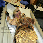 fatty_omentum_L.JPG