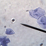 cell_cheek_03_400x.jpg
