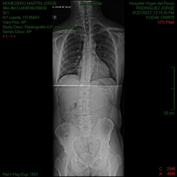 [Radiografia_Jorge_Monedero1.jpg]