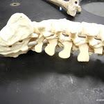 spinous_lumbar.JPG