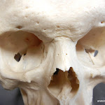 zygomatic_unlabeled.JPG