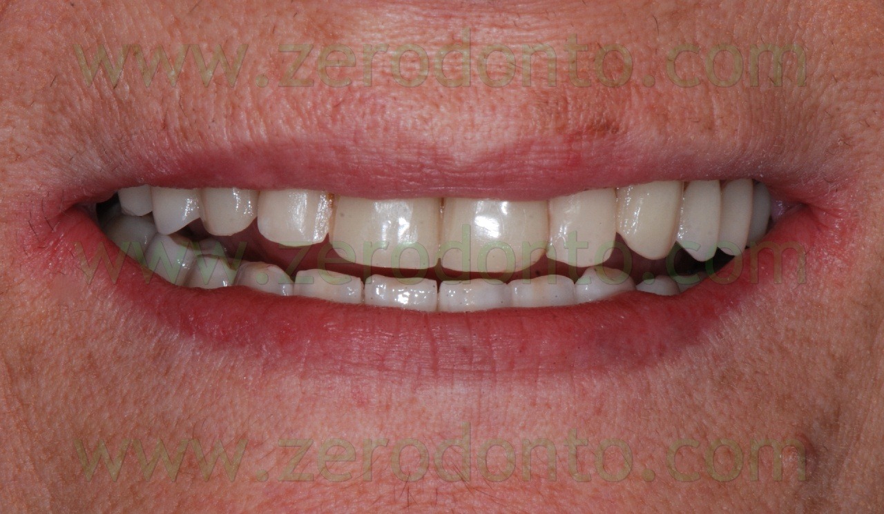 [sorriso2.jpg]