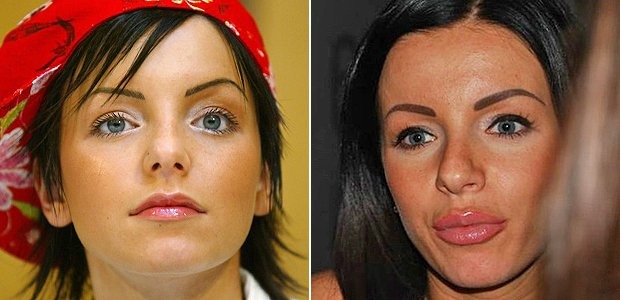 Yulia Volkova (ex-t.A.T.u) Yulia Volkova (ex-TATU)