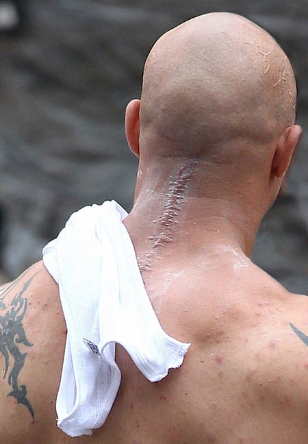 Tom Hardy