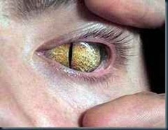 olhos_reptilianos olhos_reptilianos